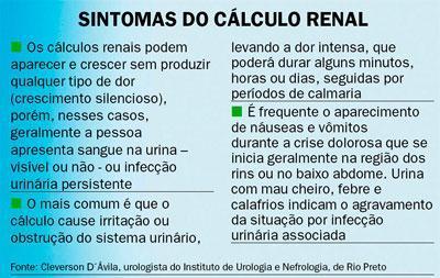 calculo-renal-sintomas