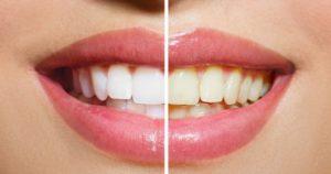 Hábitos que clareiam ou escurecem os dentes