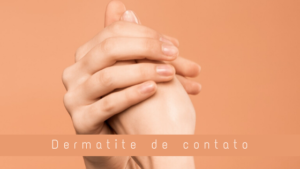 Dermatite de contato: saiba o que é, como tratar e causas